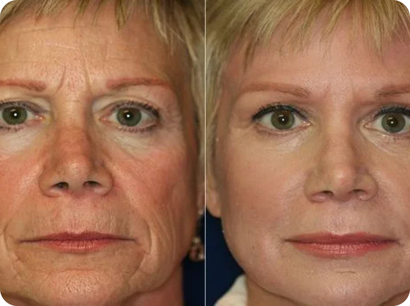 Olavita Liquid Solution Reviews